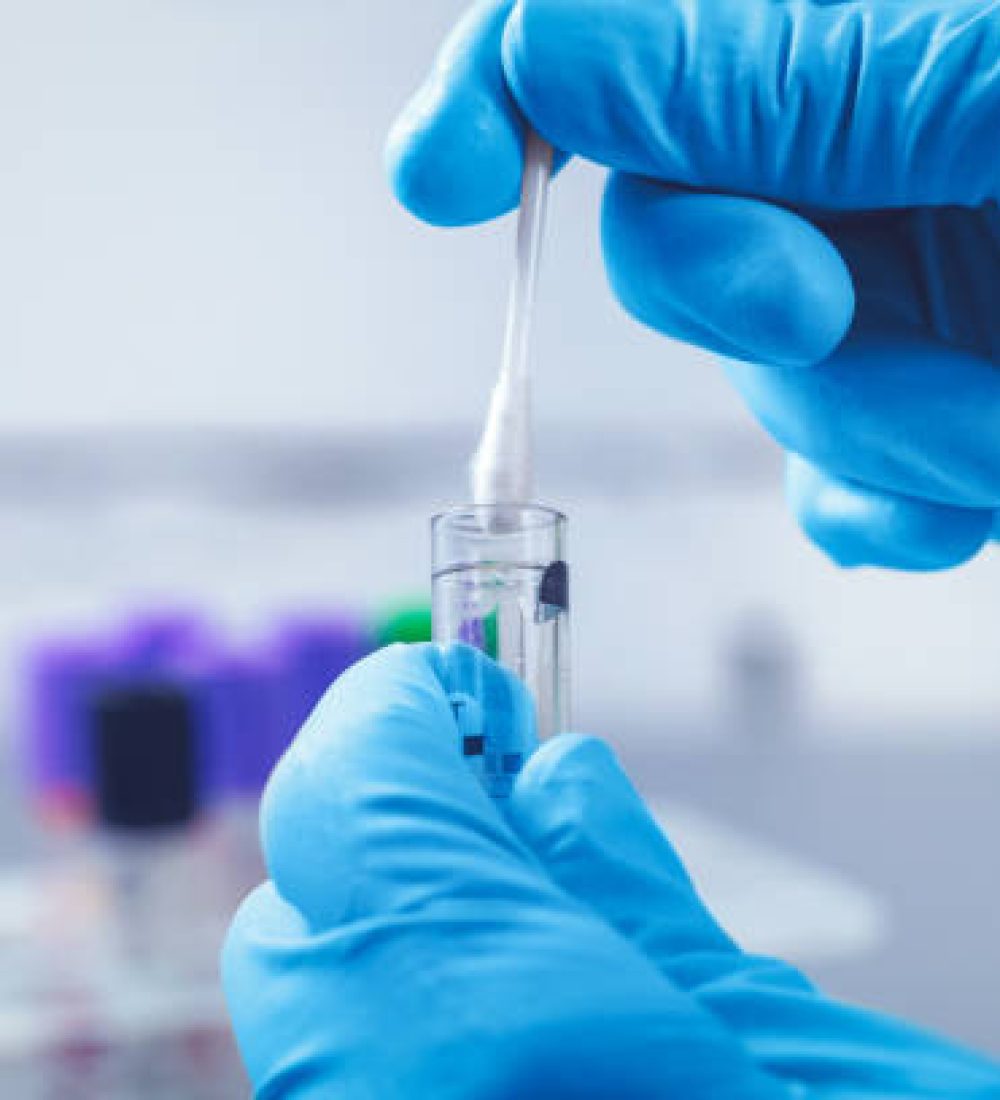 scientist in lab collect dna sample in test tube with cotton swab